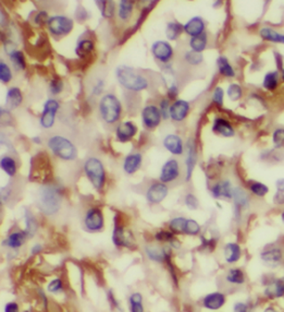 LPCAT1 Antibody