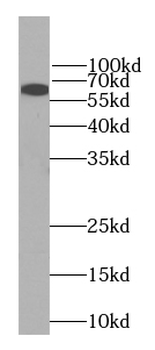 LCP1 Antibody
