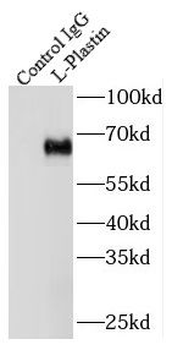 LCP1 Antibody