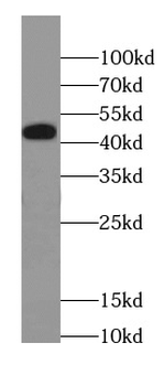 CACNA1C Antibody