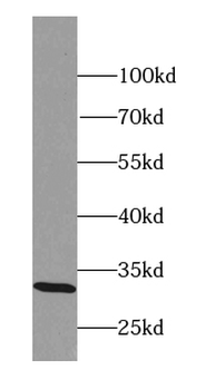 MARCHF8 Rabbit Polyclonal Antibody