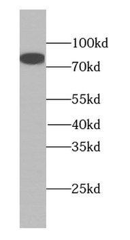 MDM1 Antibody