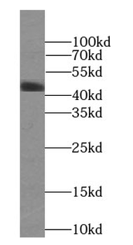 MAP2K4 Rabbit Polyclonal Antibody