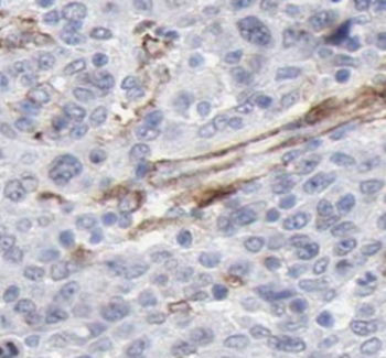 MAP2K4 Rabbit Polyclonal Antibody