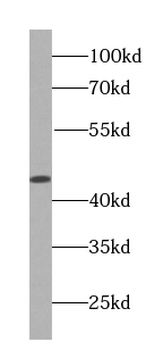 MAP2K4 Rabbit Polyclonal Antibody