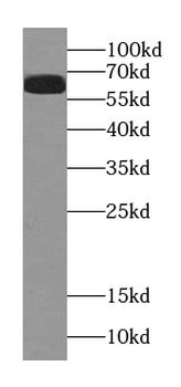MAP3K2 Rabbit Polyclonal Antibody