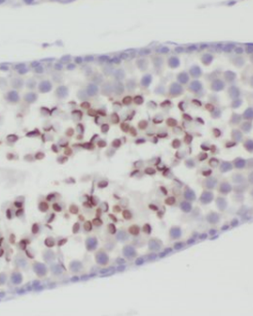 MFSD2A Rabbit Polyclonal Antibody