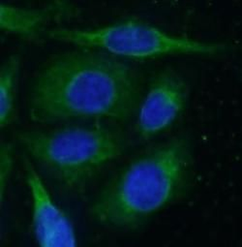 ERRFI1 Rabbit Polyclonal Antibody