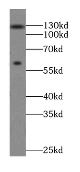 FAN1 Rabbit Polyclonal Antibody