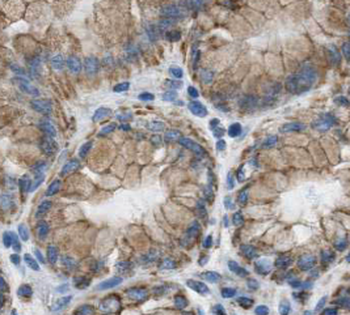 MKLN1 Rabbit Polyclonal Antibody