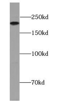 MYH4 Specific Rabbit Polyclonal Antibody