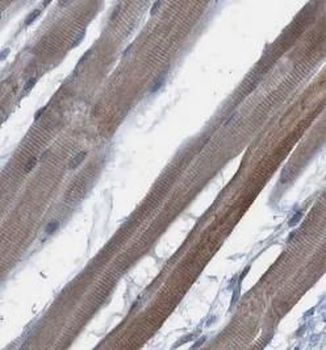MYH4 Specific Rabbit Polyclonal Antibody