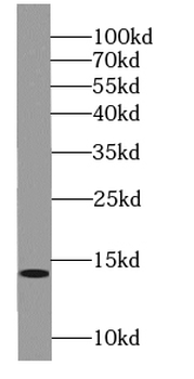 SSNA1 Rabbit Polyclonal Antibody