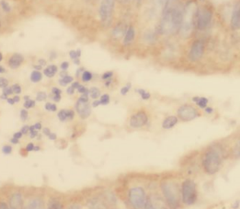 SSNA1 Rabbit Polyclonal Antibody