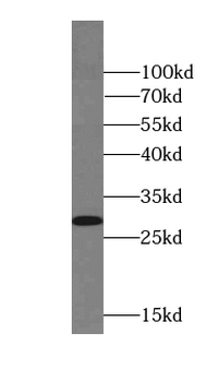 CIAO3 Specific Rabbit Polyclonal Antibody