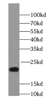 NCALD Mouse Monoclonal Antibody