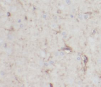 NCALD Mouse Monoclonal Antibody