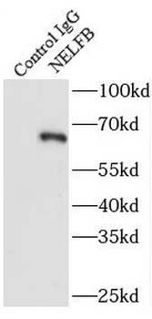 NELFB Rabbit Polyclonal Antibody