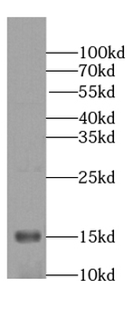 NRGN Rabbit Polyclonal Antibody