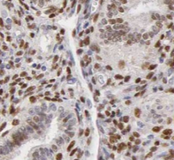 ILF2 Antibody