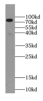 NGEF Rabbit Polyclonal Antibody