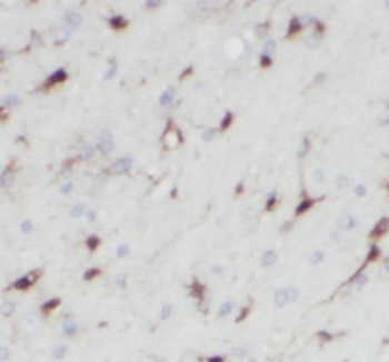 NGEF Rabbit Polyclonal Antibody