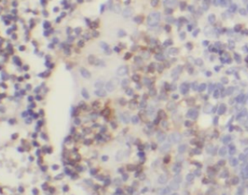 NINJ2 Mouse Monoclonal Antibody