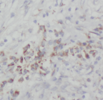 NOB1 Antibody