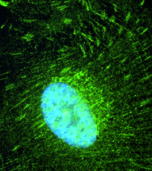 IQCB1 Rabbit Polyclonal Antibody