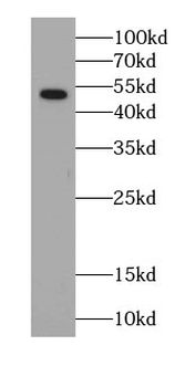 SLC17A1 Rabbit Polyclonal Antibody