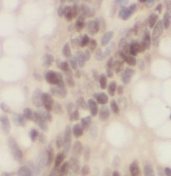 POU2F1 Rabbit Polyclonal Antibody