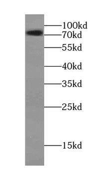 SLC22A5 Rabbit Polyclonal Antibody