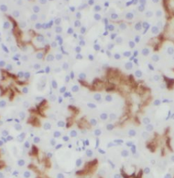 SLC22A5 Rabbit Polyclonal Antibody