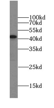 ZNF830 Rabbit Polyclonal Antibody