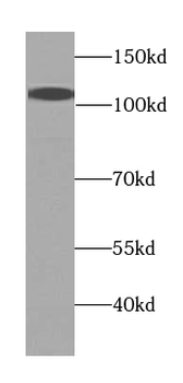 USO1 Rabbit Polyclonal Antibody