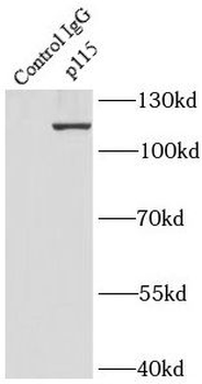 USO1 Rabbit Polyclonal Antibody