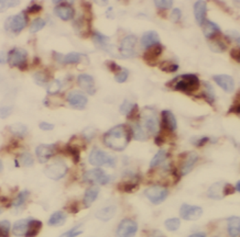 USO1 Rabbit Polyclonal Antibody