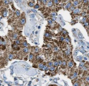BCAR1 Antibody