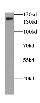 DCTN1 Rabbit Polyclonal Antibody