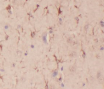 DCTN1 Rabbit Polyclonal Antibody