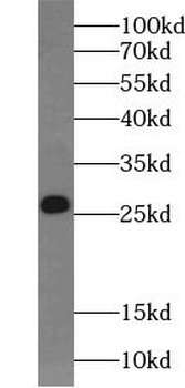 CDKN1B Rabbit Polyclonal Antibody