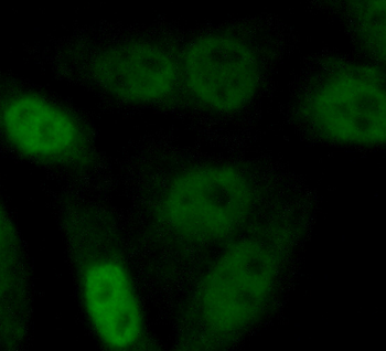 CDKN1B Rabbit Polyclonal Antibody