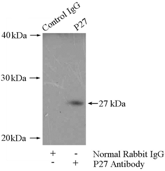 CDKN1B Rabbit Polyclonal Antibody