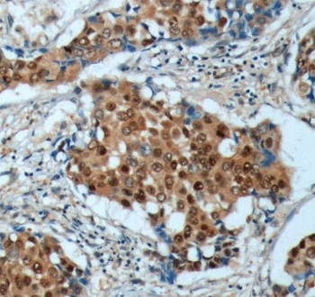 CDKN1B Rabbit Polyclonal Antibody