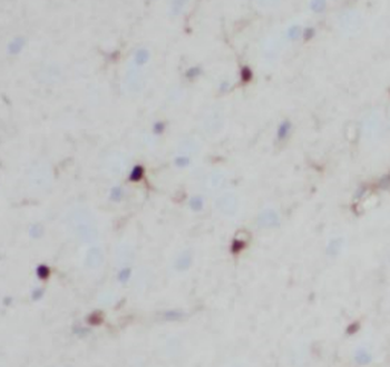 PCSK5 Rabbit Polyclonal Antibody