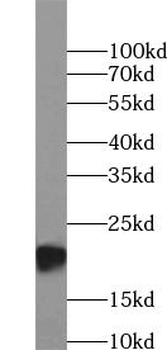 PRDX2 Mouse Monoclonal Antibody