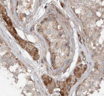 PRDX2 Mouse Monoclonal Antibody