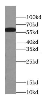 PFKFB3 Specific Rabbit Polyclonal Antibody