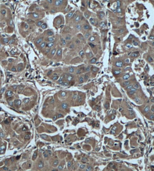 PFKFB3 Specific Rabbit Polyclonal Antibody