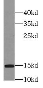 PFN2 Mouse Monoclonal Antibody